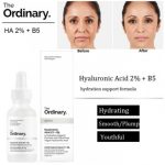 The Ordinary Hyaluronic Acid 2% + B5 - 60ml